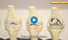 Dr Yan Knee Replacement