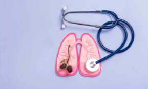 Lung