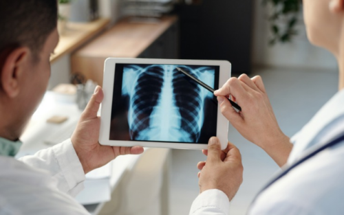 Interventional Pulmonology Centre 640 X 400 Px