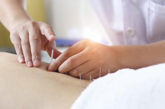 Health Article Acupunture In Chinese Medicine