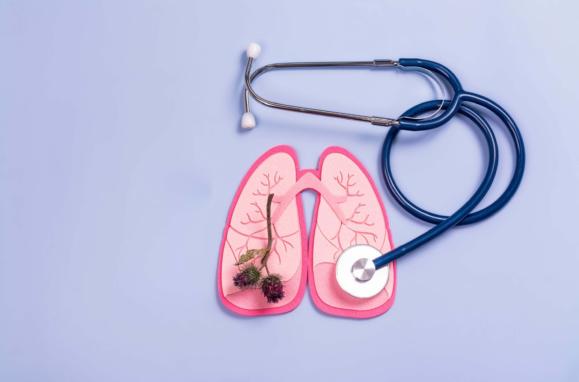 Lung